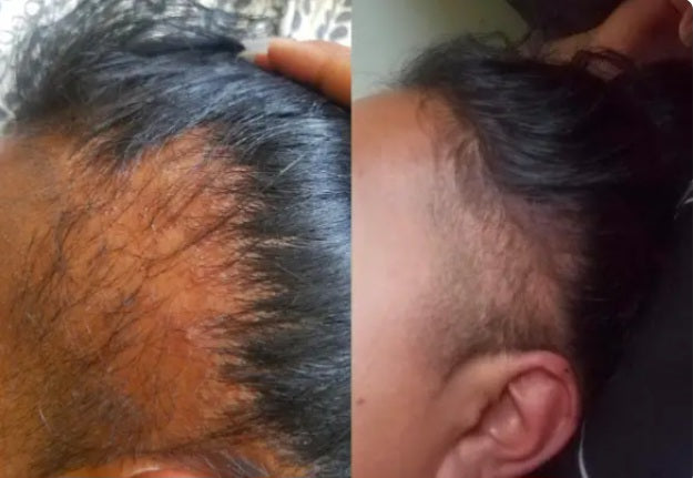 Transformation Tea Tree Bundle