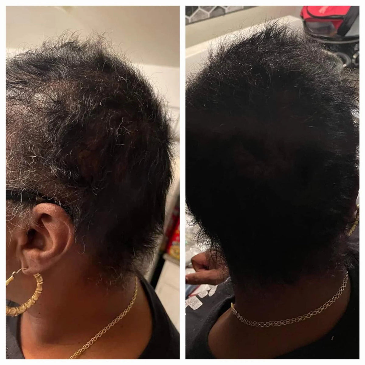 Healthy Roots Hair Growth Trio - HAIR GODDESS LA